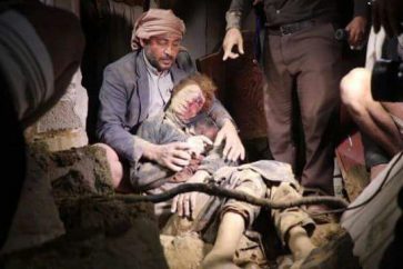 Les images affreuses du massacre saoudien au Yémen