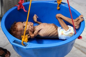 yemen-famine1