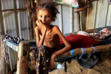 famine_yemen