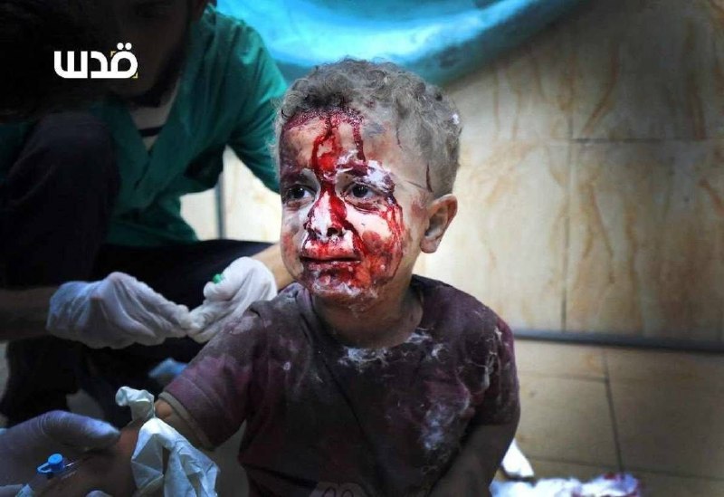 Cet enfant est l’un des rescapés des 44 massacres israéliens perpétrés contre la bande de Gaza