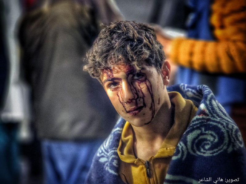  Un survivant du massacre de Rafah perpétré pour libérer les deus captifs israéliens