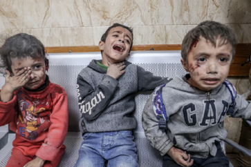 Des enfants palestiniens blessés par les bombardements israéliens contre Gaza