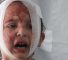 Un enfant Gazaoui blessé suite aux bombardements israéliens contre Gaza
