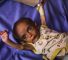 Un bébé palestinien souffrant de malnutrition due au blocus israélien contre Gaza.